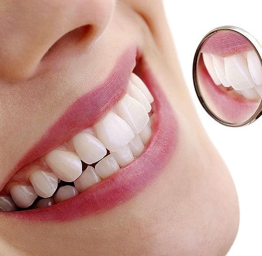 Teeth Whitening Treatment In Magnolia, TX