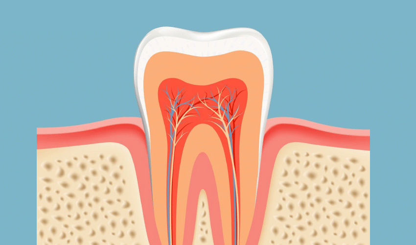 Root Canal Treatment Magnolia